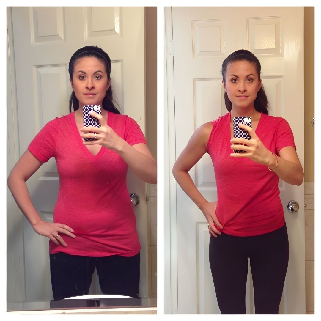Testimonianza cliente AdipePatch Roma